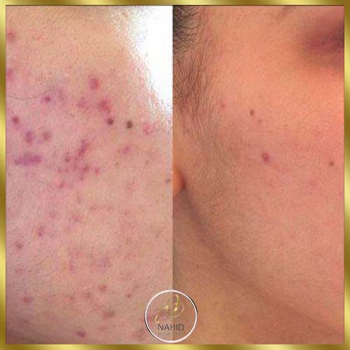 گالری پاکسازی پوست